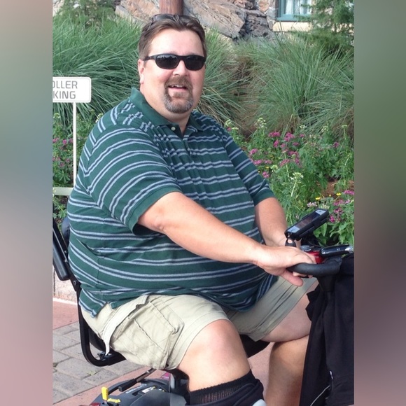 Raising money to help pay for my skin removal surgery after dropping 200 pounds! - Picture 4 of 5